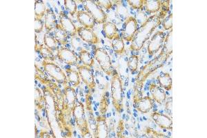 Immunohistochemistry of paraffin-embedded mouse kidney using  antibody (ABIN6129195, ABIN6137096, ABIN6137097 and ABIN6220538) at dilution of 1:100 (40x lens). (ARHGEF5 anticorps  (AA 1248-1597))