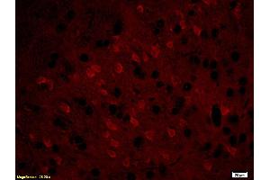 anti-MBP (AA 69-85) antibody