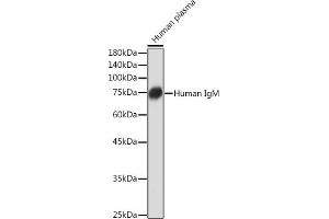 Western blot analysis of extracts of Human plasma, using Human IgM Rabbit mAb (ABIN7267845) at 1:1000 dilution. (IGHM anticorps)