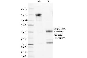 SDS-PAGE Analysis Purified Bcl-2 Mouse Monoclonal Antibody (100/D5).