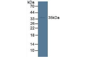 Detection of SDH in Mouse Liver Tissue using Polyclonal Antibody to Sorbitol Dehydrogenase (SDH) (SORD anticorps  (AA 98-355))