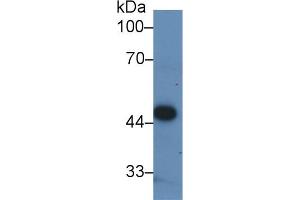 Detection of PDHA1 in Human ECV304 cell lysate using Polyclonal Antibody to Pyruvate dehydrogenase alpha 1 (PDHA1) (PDHA1 anticorps  (AA 30-390))