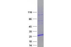 Validation with Western Blot