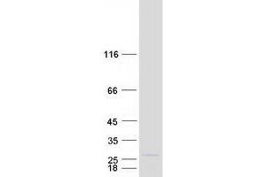 Validation with Western Blot