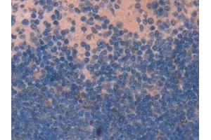 Detection of NUCB2 in Mouse Spleen Tissue using Polyclonal Antibody to Nucleobindin 2 (NUCB2)