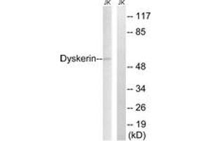 Western blot analysis of extracts from JurKat cells, using Dyskerin Antibody. (DKC1 anticorps  (AA 171-220))