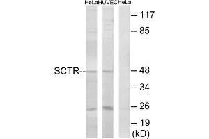 Western blot analysis of extracts from HeLa cells and HUVEC cells, using SCTR antibody. (SCTR anticorps  (Internal Region))