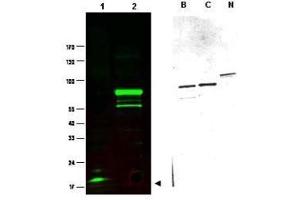Western blot using  Protein A purified anti-SPANX-C antibody shows detection of a band at ~17 kDa corresponding to SPANX-C present in a nuclear extract from VWM105 cells (left panel, arrowhead). (SPANXC anticorps)