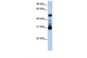 Image no. 1 for anti-Activin A Receptor Type II-Like 1 (ACVRL1) (AA 38-87) antibody (ABIN6738113) (ACVRL1 anticorps  (AA 38-87))