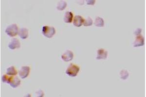 Immunocytochemistry of caspase-2 in A-20 cells with AP30196PU-N caspase-2 antibody at 2 μg/ml. (Caspase 2 anticorps  (N-Term))