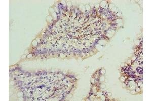 Immunohistochemistry of paraffin-embedded human small intestine tissue using ABIN7152648 at dilution of 1:100