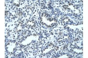 Rabbit Anti-IKZF4 Antibody Catalog Number: ARP33275  Paraffin Embedded Tissue: Human alveolar cell  Cellular Data: Epithelial cells of renal tubule Antibody Concentration:  4. (IKZF4 anticorps  (N-Term))