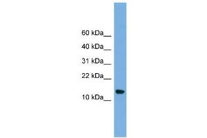 WB Suggested Anti-LSM8 Antibody Titration:  0.