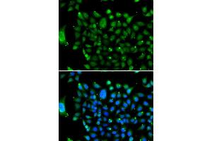 Immunofluorescence analysis of U2OS cells using NCOR1 antibody (ABIN6130574, ABIN6144420, ABIN6144421 and ABIN6222831).