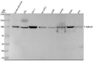 Western blot analysis of P-Selectin/SELP using anti-P-Selectin/SELP antibody (ABIN7604350).