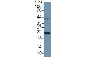Detection of APOM in Mouse Placenta lysate using Polyclonal Antibody to Apolipoprotein M (APOM) (Apolipoprotein M anticorps  (AA 20-190))