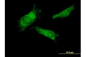 Immunofluorescence of purified MaxPab antibody to RNF14 on HeLa cell.