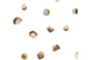 Immunocytochemistry of CTRP7 in HL60 cells with AP30258PU-N CTRP7 antibody at 0.