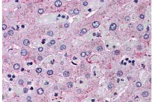 Immunohistochemistry (Formalin/PFA-fixed paraffin-embedded sections) of human liver tissue with GCGR polyclonal antibody . (Glucagon Receptor anticorps  (Extracellular Domain))