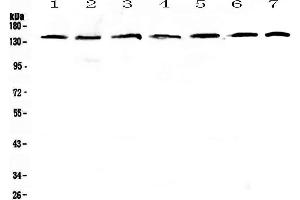Western blot analysis of PERK using anti-PERK antibody . (PERK anticorps  (AA 222-334))
