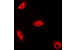Immunofluorescent analysis of Perforin 1 staining in K562 cells. (Perforin 1 anticorps)