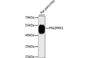 Western blot analysis of extracts of rat pancreas, using PNLIPRP2 antibody (ABIN6292243) at 1:3000 dilution.