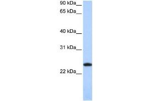 Western Blotting (WB) image for anti-Ferritin, Light Polypeptide (FTL) antibody (ABIN2459726) (FTL anticorps)