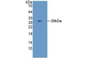 Detection of Recombinant CHRNe, Mouse using Polyclonal Antibody to Cholinergic Receptor, Nicotinic, Epsilon (CHRNe)