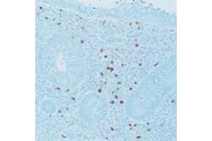 Immunohistochemical staining for paraffin-embedded human appendix section using Mast Cell Tryptase monoclonal antibody, clone 10D11 . (Mast Cell Tryptase anticorps)