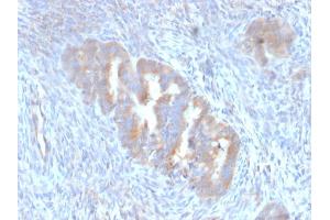 Formalin-fixed, paraffin-embedded human Endometrium stained with ATG5 Mouse Monoclonal Antibody (ATG5/2101).