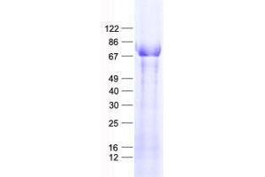 Validation with Western Blot