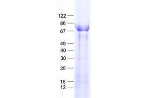 Validation with Western Blot (Zinc Finger Protein 354B (ZNF354B) protein (His tag))