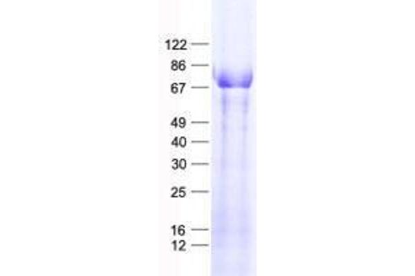 Zinc Finger Protein 354B (ZNF354B) protein (His tag)