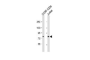 All lanes : Anti-ND5 Antibody (C-term) at 1:1000 dilution Lane 1: CCRF-CEM whole cell lysate Lane 2: Jurkat whole cell lysate Lysates/proteins at 20 μg per lane. (MT-ND5 anticorps  (C-Term))
