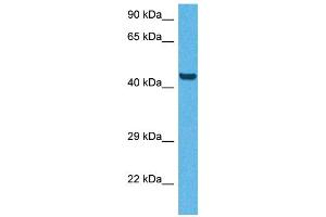 Host:  Rabbit  Target Name:  CD36  Sample Tissue:  Human HepG2 Whole Cell  Antibody Dilution:  1ug/ml (CD36 anticorps  (N-Term))
