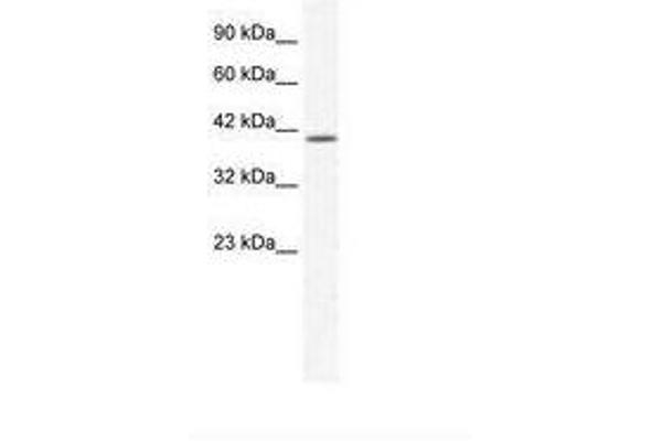 KCNK13 Antikörper  (C-Term)