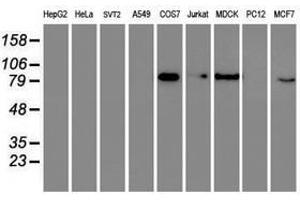 Image no. 6 for anti-General Transcription Factor IIF, Polypeptide 1, 74kDa (GTF2F1) antibody (ABIN1500597)