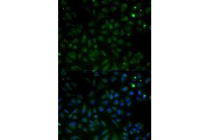 Immunofluorescence analysis of HeLa cells using VDAC1 antibody. (VDAC1 anticorps  (AA 1-283))
