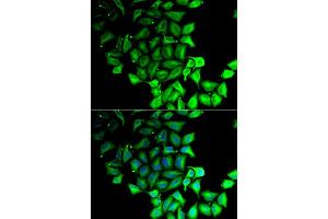 Immunofluorescence analysis of MCF-7 cell using RPS7 antibody. (RPS7 anticorps)