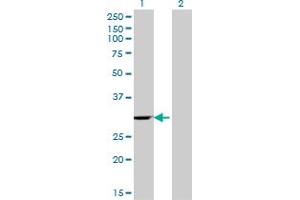 Western Blot analysis of WBSCR1 expression in transfected 293T cell line by WBSCR1 monoclonal antibody (M07), clone 4B2.