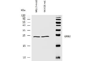 Western bloting analysis of human GRB2 using rabbit polyclonal antibody PAb (554) on lysates of MOLT-4 and RAMOS cell lines under reducing conditions. (GRB2 anticorps  (AA 198-217))