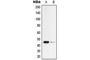 Western blot analysis of Serpin B4 expression in HepG2 (A), PC12 (B) whole cell lysates. (SERPINB4 anticorps  (Center))