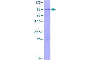 Image no. 1 for Glutamic Pyruvate Transaminase (Alanine Aminotransferase) 2 (GPT2) (AA 1-523) protein (GST tag) (ABIN1355676)
