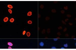 Immunofluorescence analysis of HeLa cells using Acetyl-Histone H3-K56 Polyclonal Antibody at dilution of 1:100.