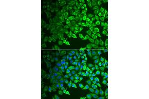 Immunofluorescence analysis of A549 cell using GIF antibody. (Intrinsic Factor anticorps)