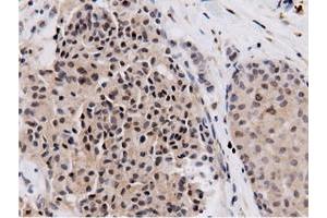 Image no. 5 for anti-5'-Nucleotidase Domain Containing 1 (NT5DC1) antibody (ABIN1499837)