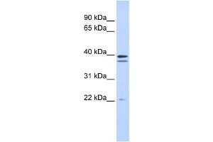 WB Suggested Anti-RABGGTB Antibody Titration:  0. (RABGGTB anticorps  (Middle Region))