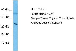 Host: Rabbit Target Name: YBX1 Sample Type: Thymus Tumor lysates Antibody Dilution: 1.