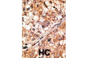 Immunohistochemistry (IHC) image for anti-BCL2-Like 11 (Apoptosis Facilitator) (BCL2L11) (BH3 Domain) antibody (ABIN2997135)