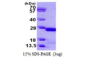 Image no. 1 for Crystallin, gamma C (CRYGC) protein (His tag) (ABIN1098275) (CRYGC Protein (His tag))